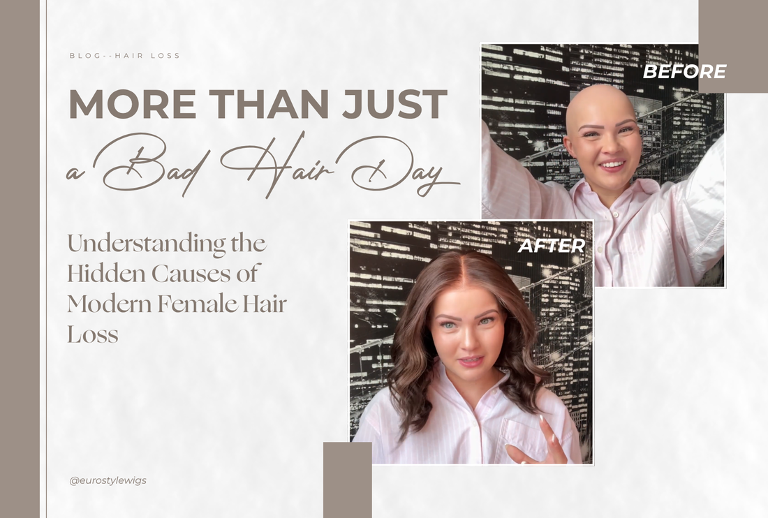 More Than Just a Bad Hair Day: Understanding the Hidden Causes of Modern Female Hair Loss